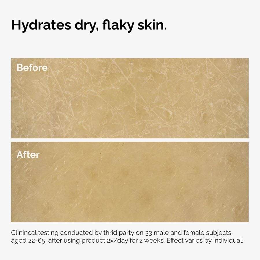 the-body-care-collection-s4 ord-natural-moisturizing-factors-inulin-body-before-after-graphic-02.jpg