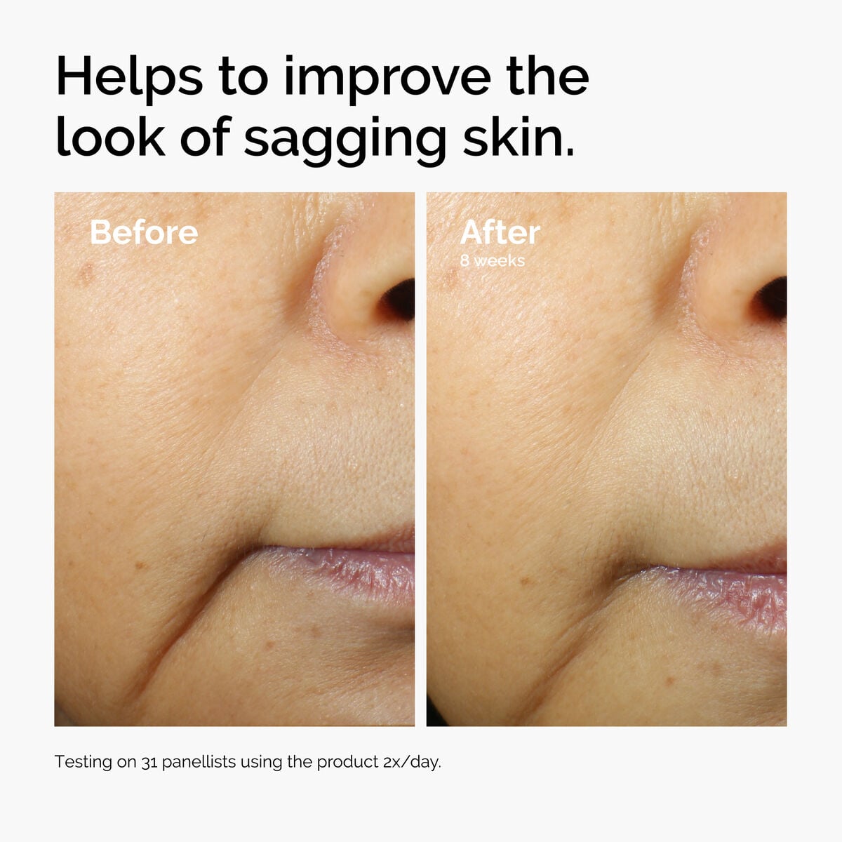 caffeine-3-escin-1-face-serum-j6 ord-caffeine-3pct-escin-1pct-face-serum-before-after-sagging.jpg