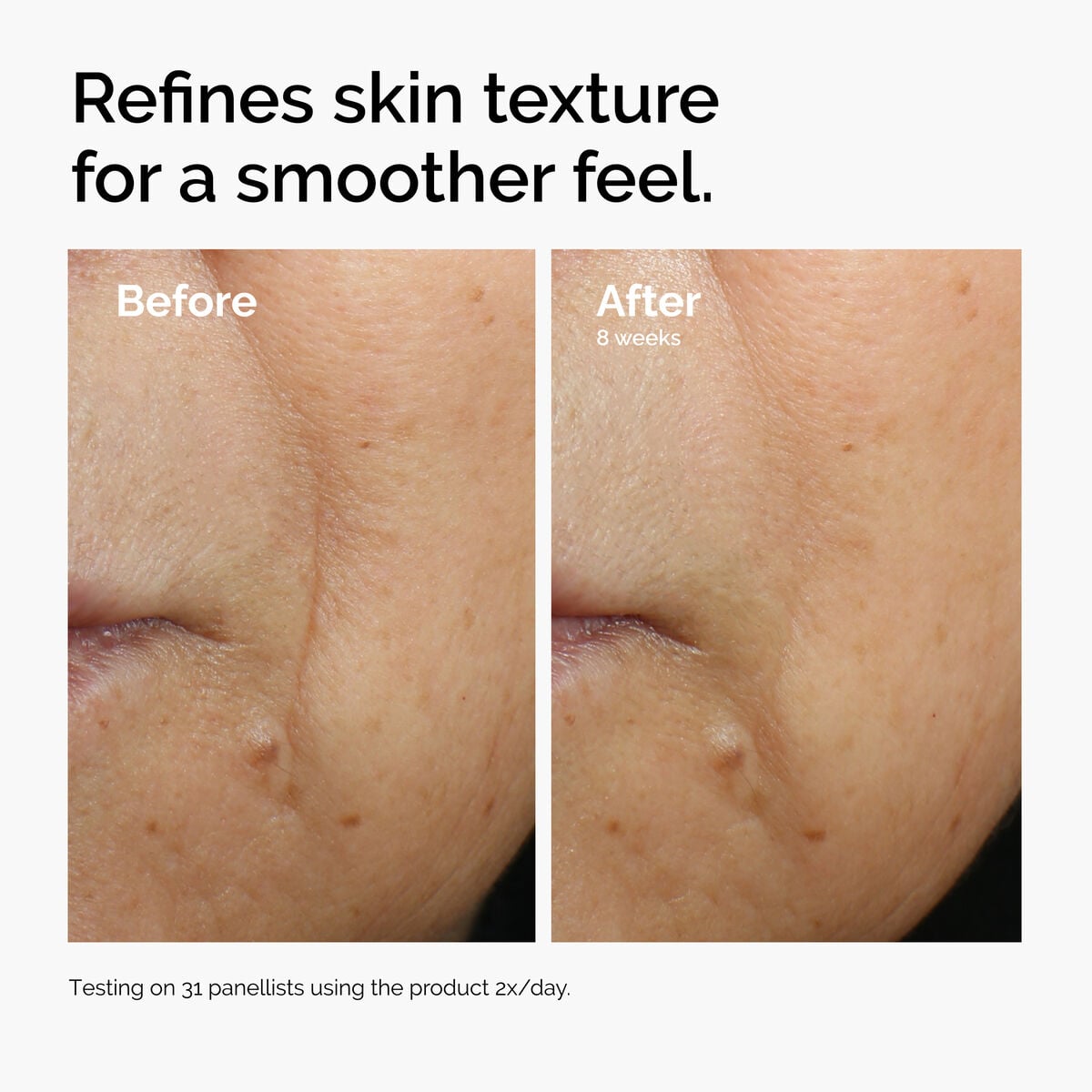 caffeine-3-escin-1-face-serum-j6 ord-caffeine-3pct-escin-1pct-face-serum-before-after-texture.jpg