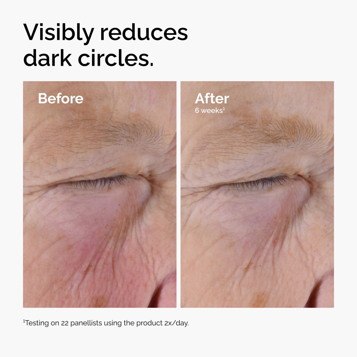 caffeine-solution-5-egcg-eye-serum-m0 ord-caffeine-solution-egcg-dark-circles-before-after.jpg