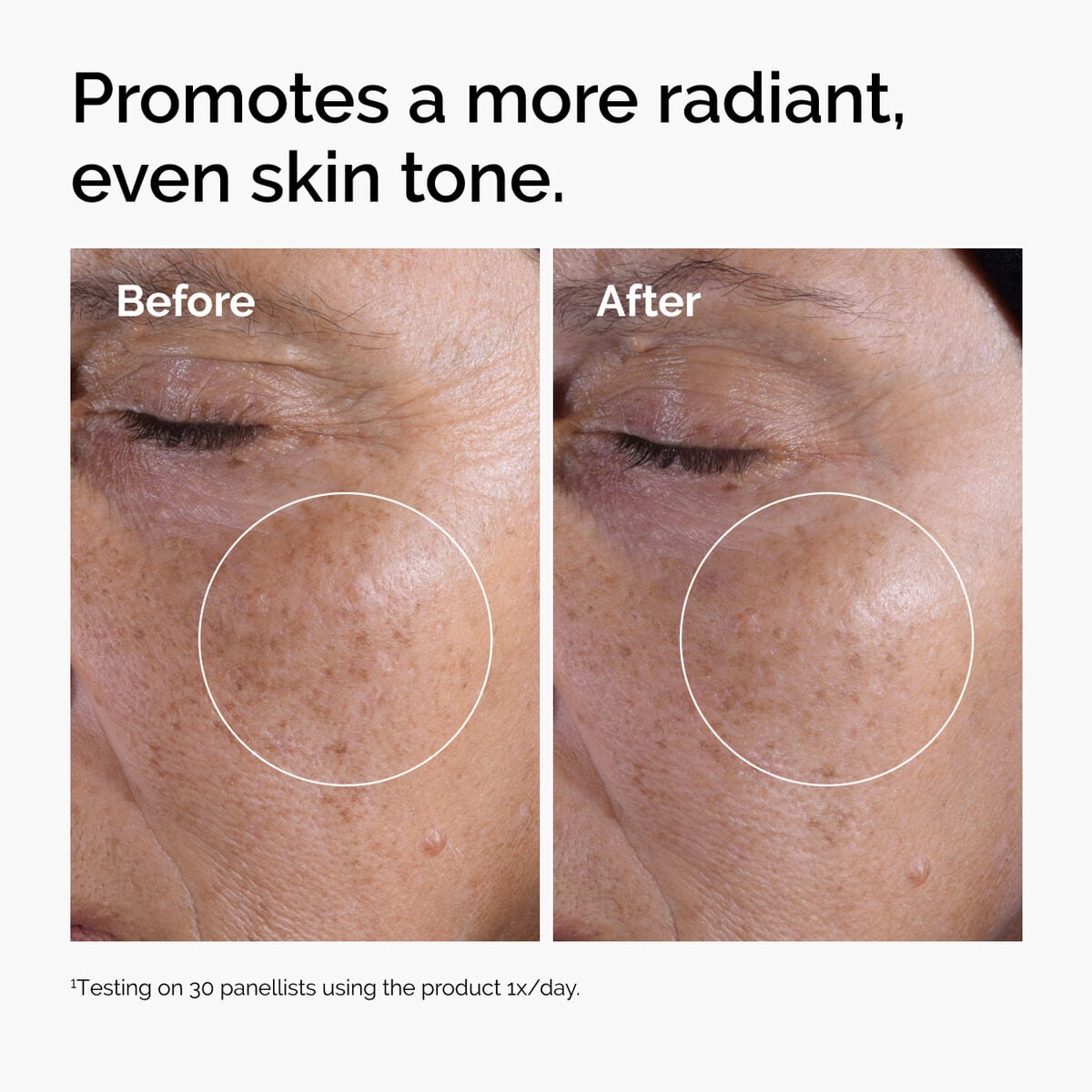 glycolic-acid-7-exfoliating-toner-g8 ord-glycolic-before-after-radiance.jpg