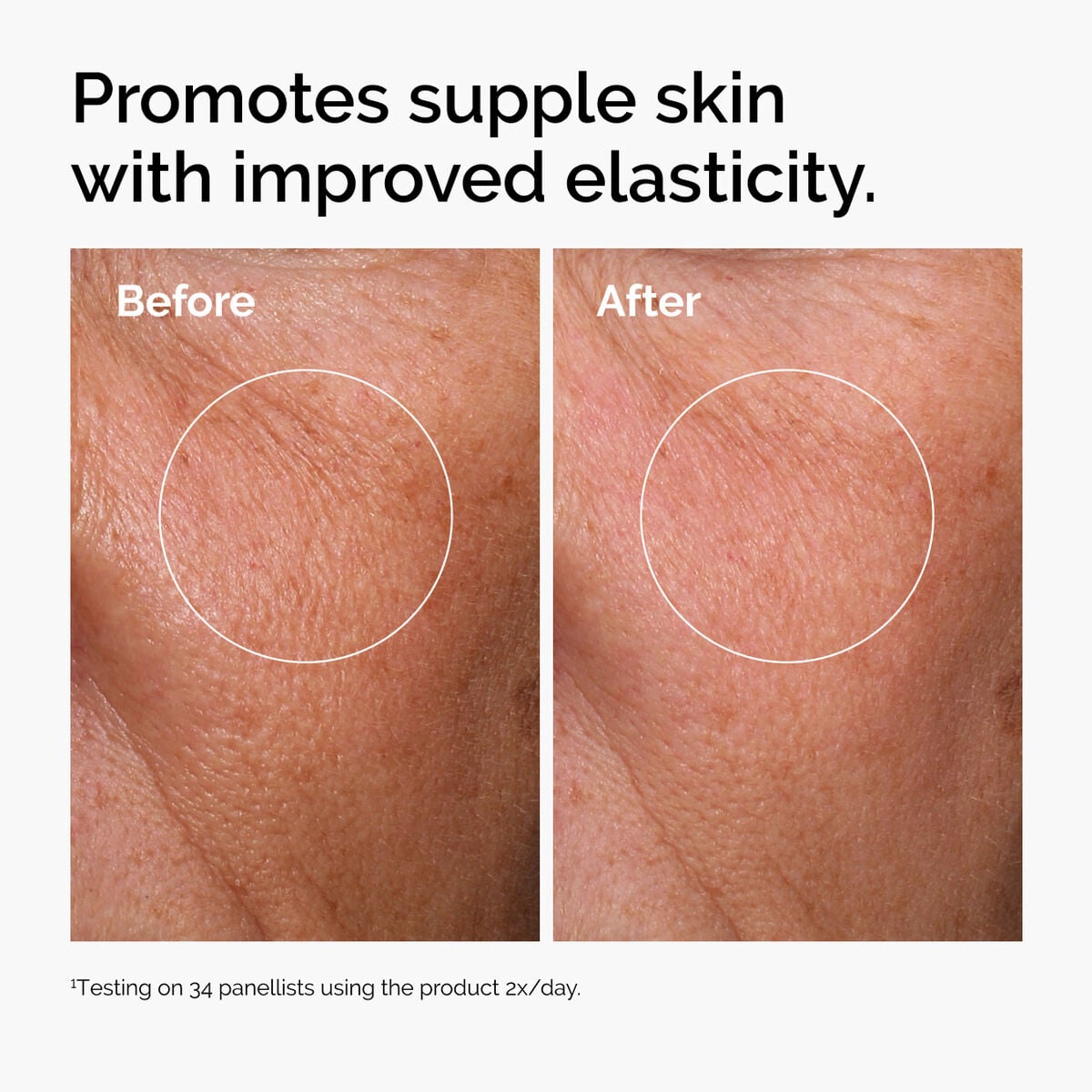 hyaluronic-acid-2-b5-with-ceramides-m4 ord-hyaluronic-acid-2pct-b5-hydrating-serum-before-after-elasticity.jpg
