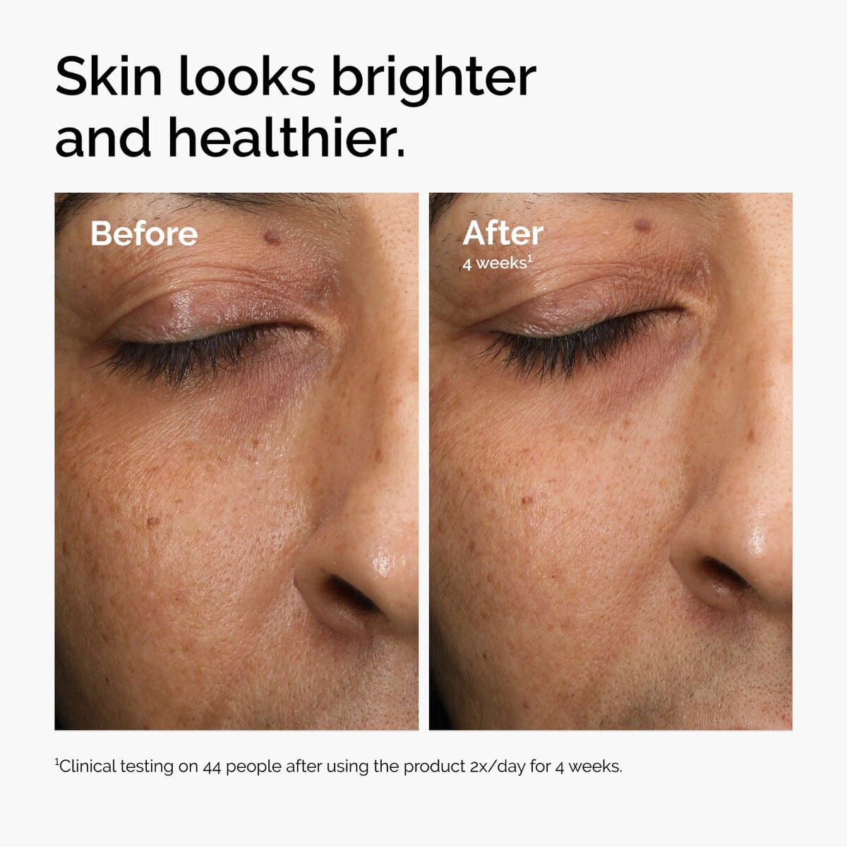 multi-antioxidant-radiance-serum-n3 ord-mars-before-after-healthy.jpg