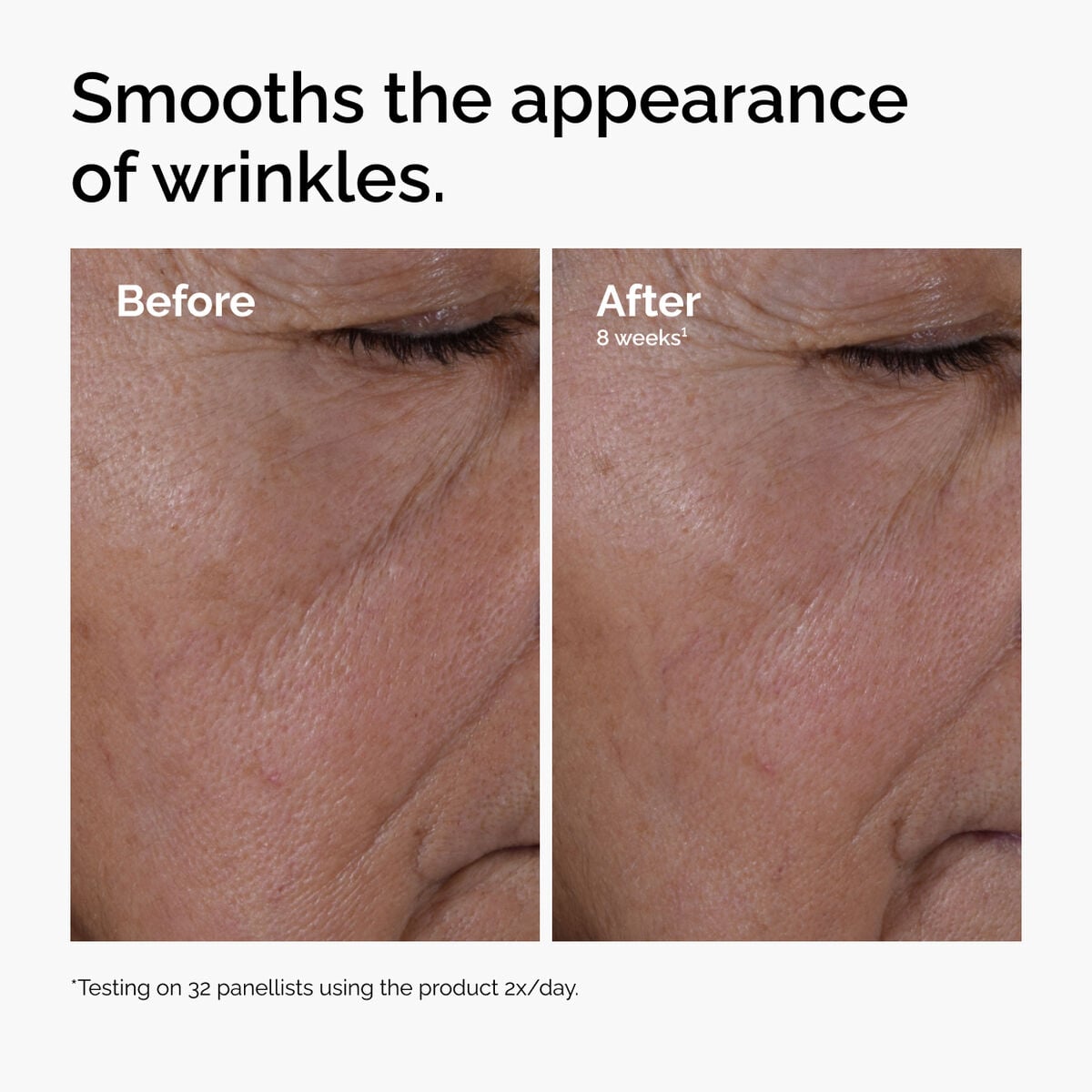 multi-peptide-ha-serum-f1 ord-multi-peptide-ha-serum-wrinkles-before-after.jpg