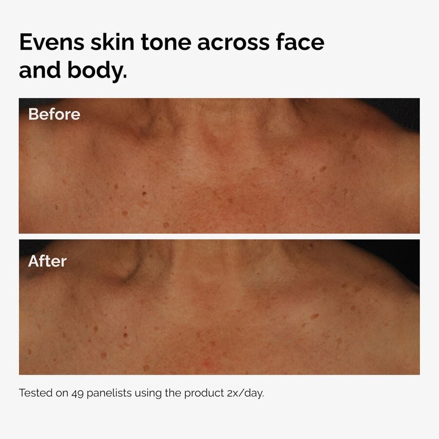 the-body-care-collection-s4 ord-niacinamide-face-body-serum-before-after-even-tone-graphic.jpg