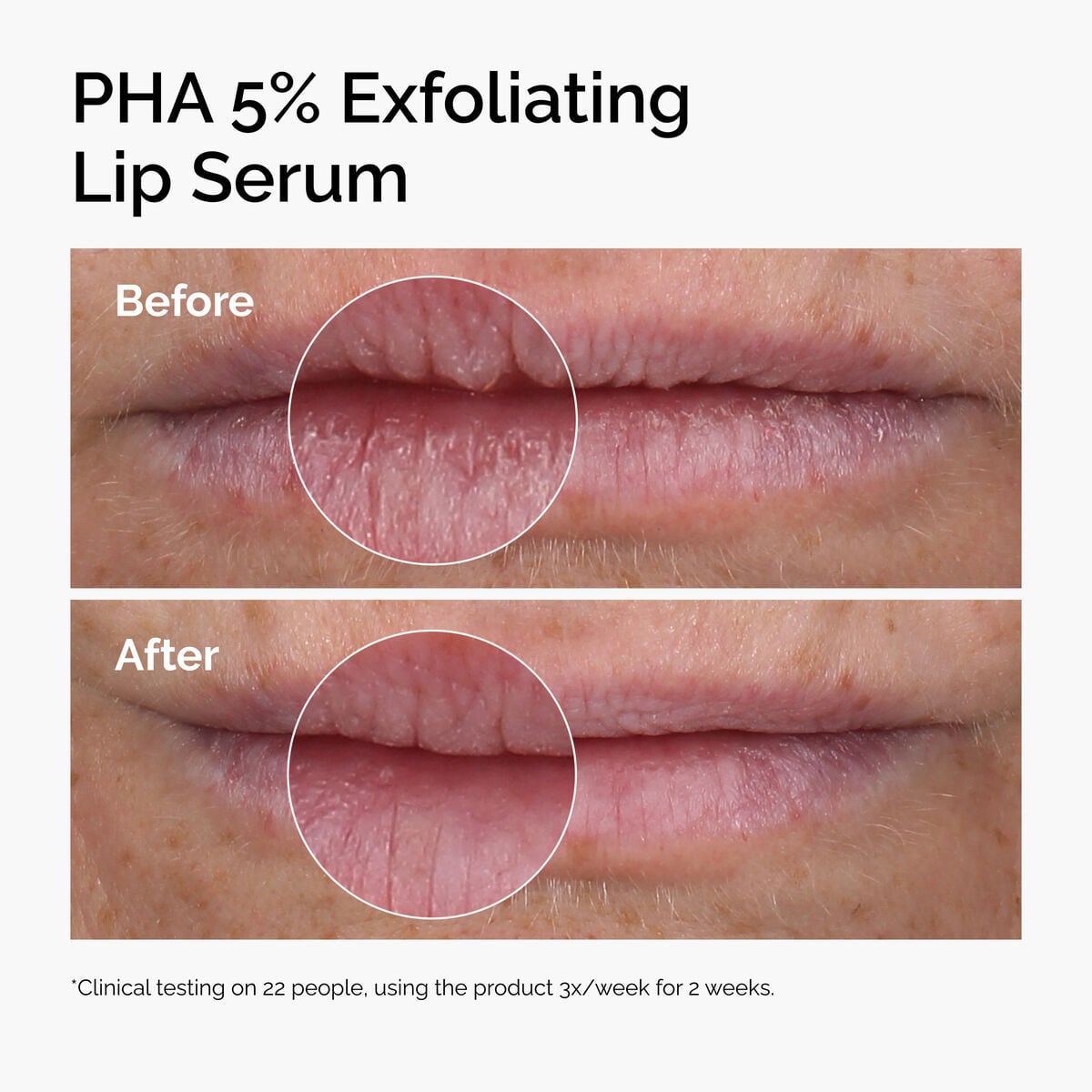 pha-5-exfoliating-lip-serum-c9 ord-pha-5pct-lip-exfoliating-serum-before-after.jpg