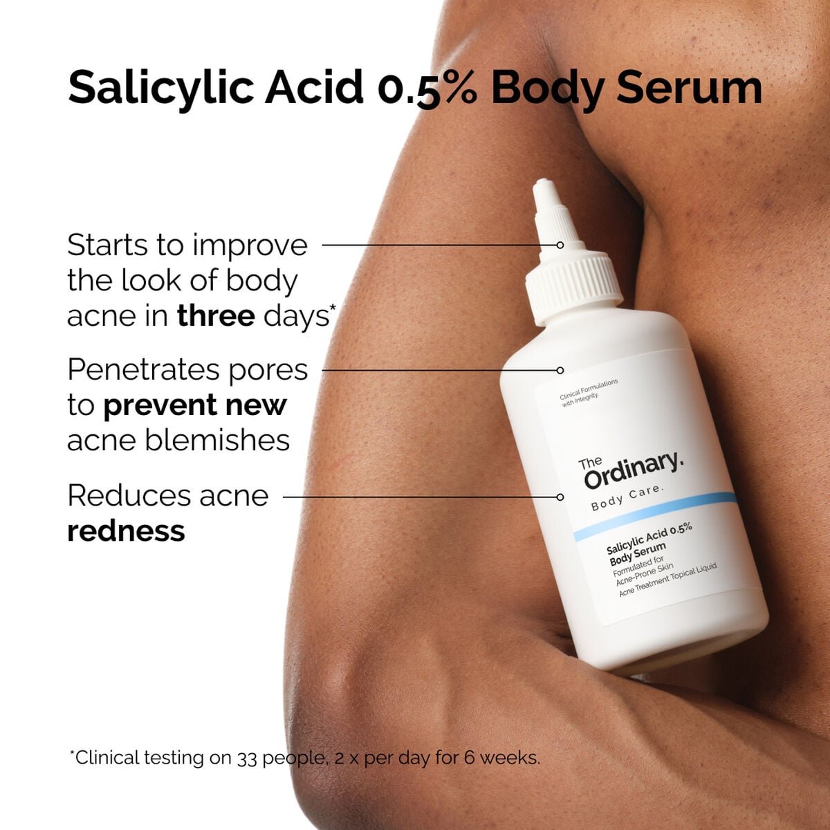 salicylic-acid-0-5-body-serum-m2 ord-salicylic-05-body-serum-otc-benefits-infographic.jpg